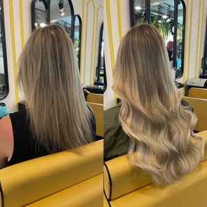Dallas Top Hair Loss Solutions - Expert Care for Trichotillomania & More